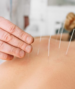 Embrace a Pain-Free Life: The Role of Acupuncture in Pain Management