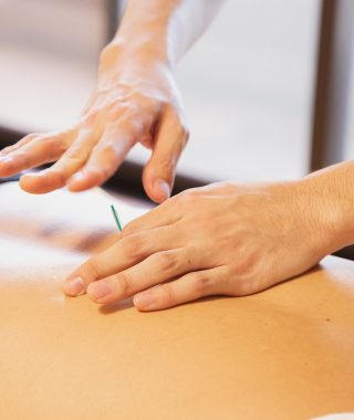 Dispelling Acupuncture Myths: What’s Fact and What’s Fiction?